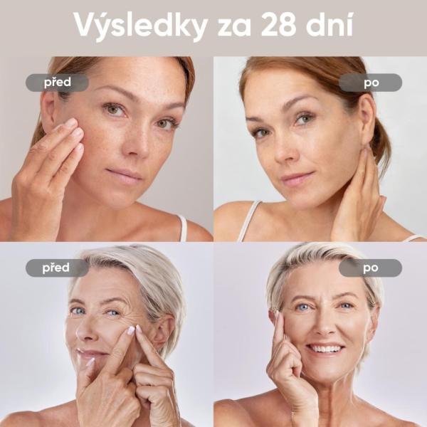 BAZAR - JOVS 4D v2 laserová světelná terapeutická maska - Poškozený obal (Komplet)10