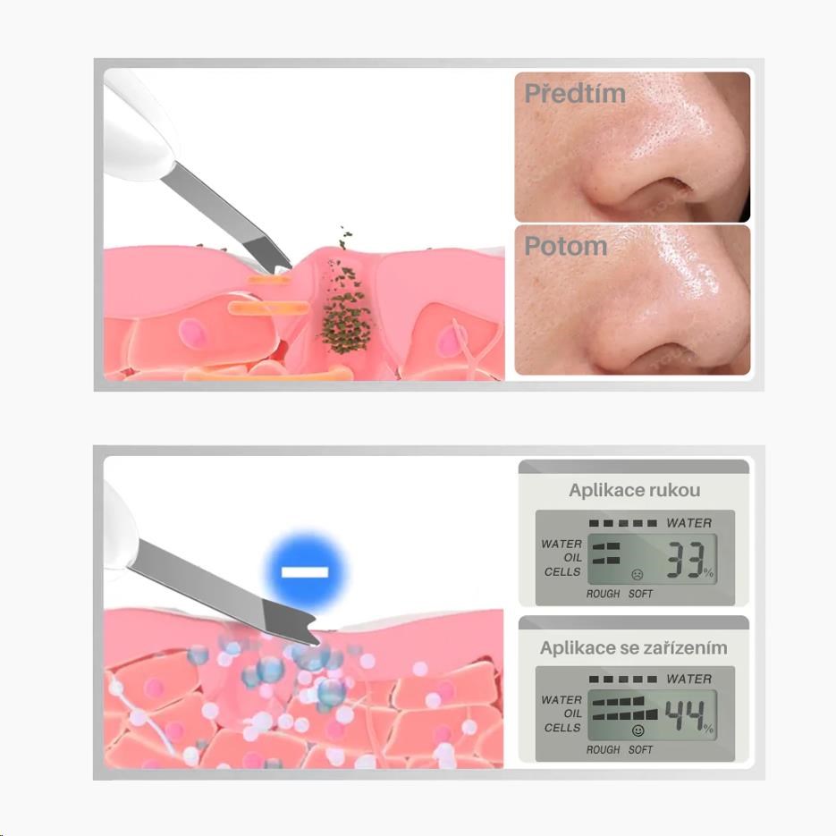 TOUCHBeauty 1887 Ultrazvuková špachtle na pleť5 